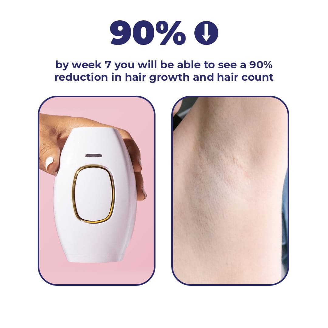 Bella Aura' Portable IPL Hair Remover
