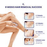Bella Aura' Portable IPL Hair Remover